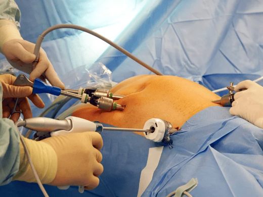 Surgical team operating at Bluebell Hospital